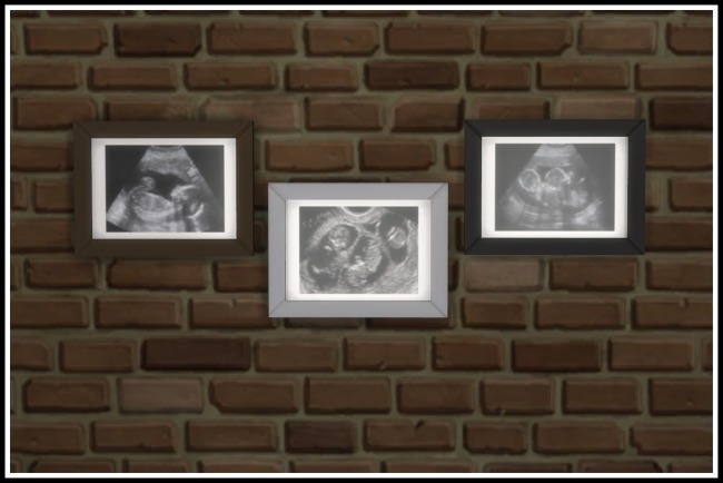 3 ultra sound scans on a brick wall, one with 1 baby, 1 with twins, and 1 with triplets 